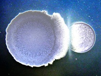 A colony of Bacillus subtilis (right) inhibits growth of human pathogen S. epidermus
